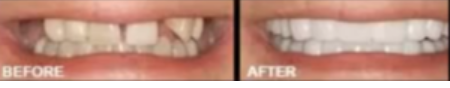 All On Four Dental Implants Long Island business image