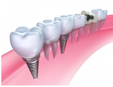 All On Four Dental Implants Long Island business image
